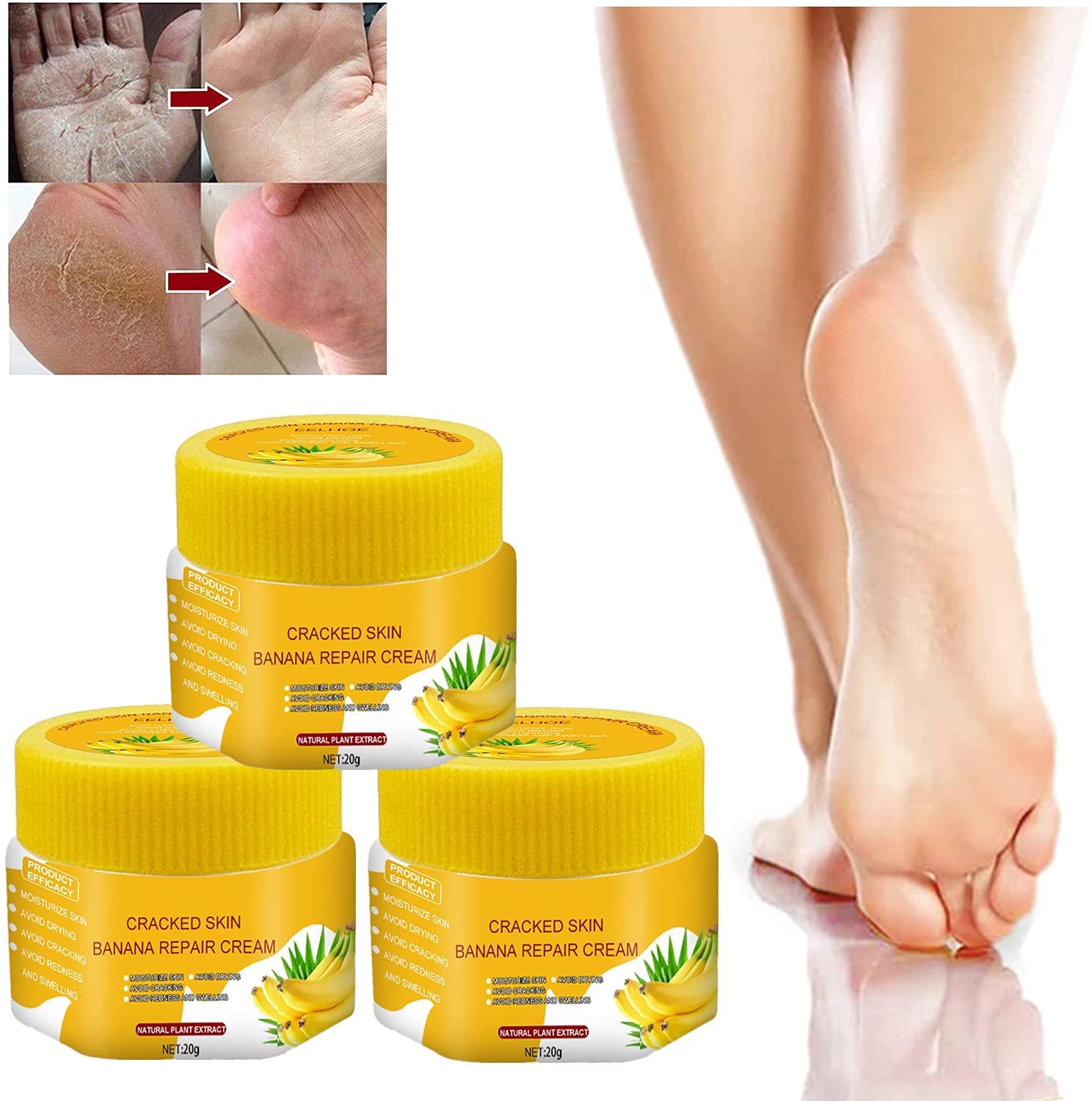 Xikangshun Heel Banana Oil Repair Cream, Banana Essence Hand and Foot Cream, Cracked Skin Banana Repair Cream, Foot Cream, Dead Skin Remover for Feet, Moisturises and Makes the Skin (3pcs), pieces.