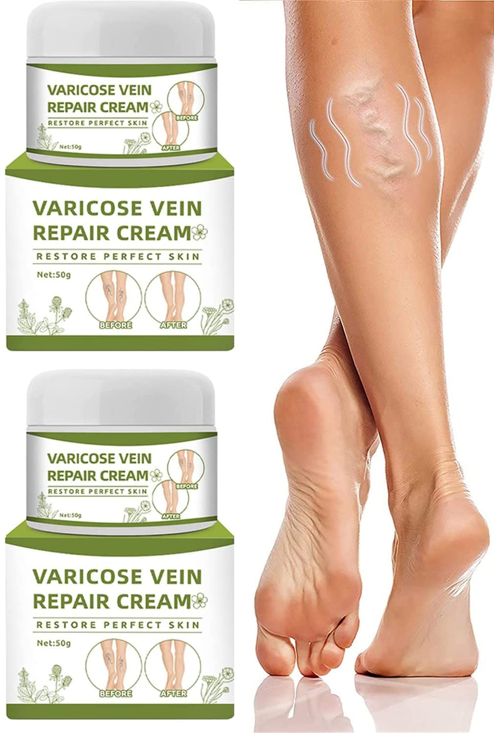 youfenghui BeauSkin Spider Vein Repair Cream, Varicose Vein Cream, Leg Swelling, Earth, ‎pack