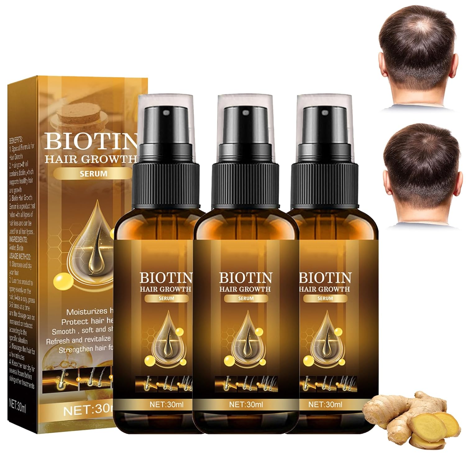 Biotin Hair Growth Spray, Biotin Hair Growth, Biotin Hair Growth Spray, Eelhoe Biotin, Accelerates Hair Growth and Prevents Hair Loss, Suitable for Damaged Dry Hair, 30 ml (Pack of 3)