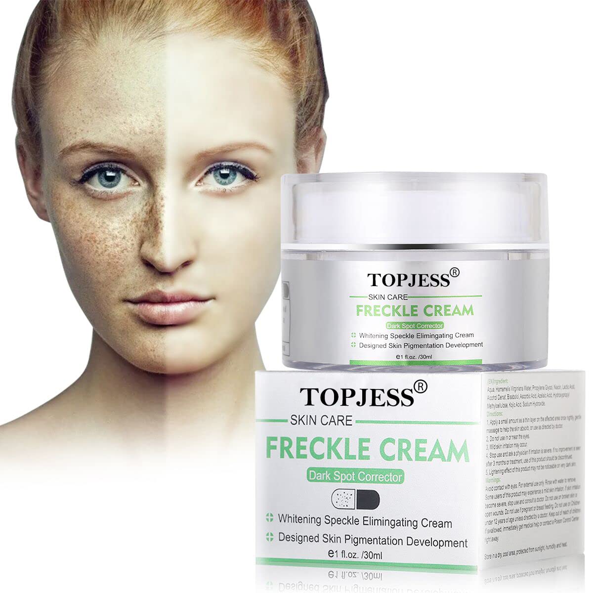 TOPJESS Whitening Cream, Altersflecken Creme, Geschenke für frauen, Anti blemish, Sommersprossen Creme, Flecken creme, Gesicht creme gegen Altersflecken/Dunkle Flecken, Dunkle Flecken Aufhellende Creme, 30 ML, ‎weiß