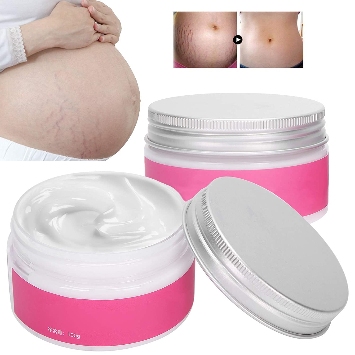 Betued Pack of 2 Stretch Marks Cream, Scar Ointment, Stretch Marks, Repair Cream, Skin Firming Pregnancy Scars Removal Repair Cream