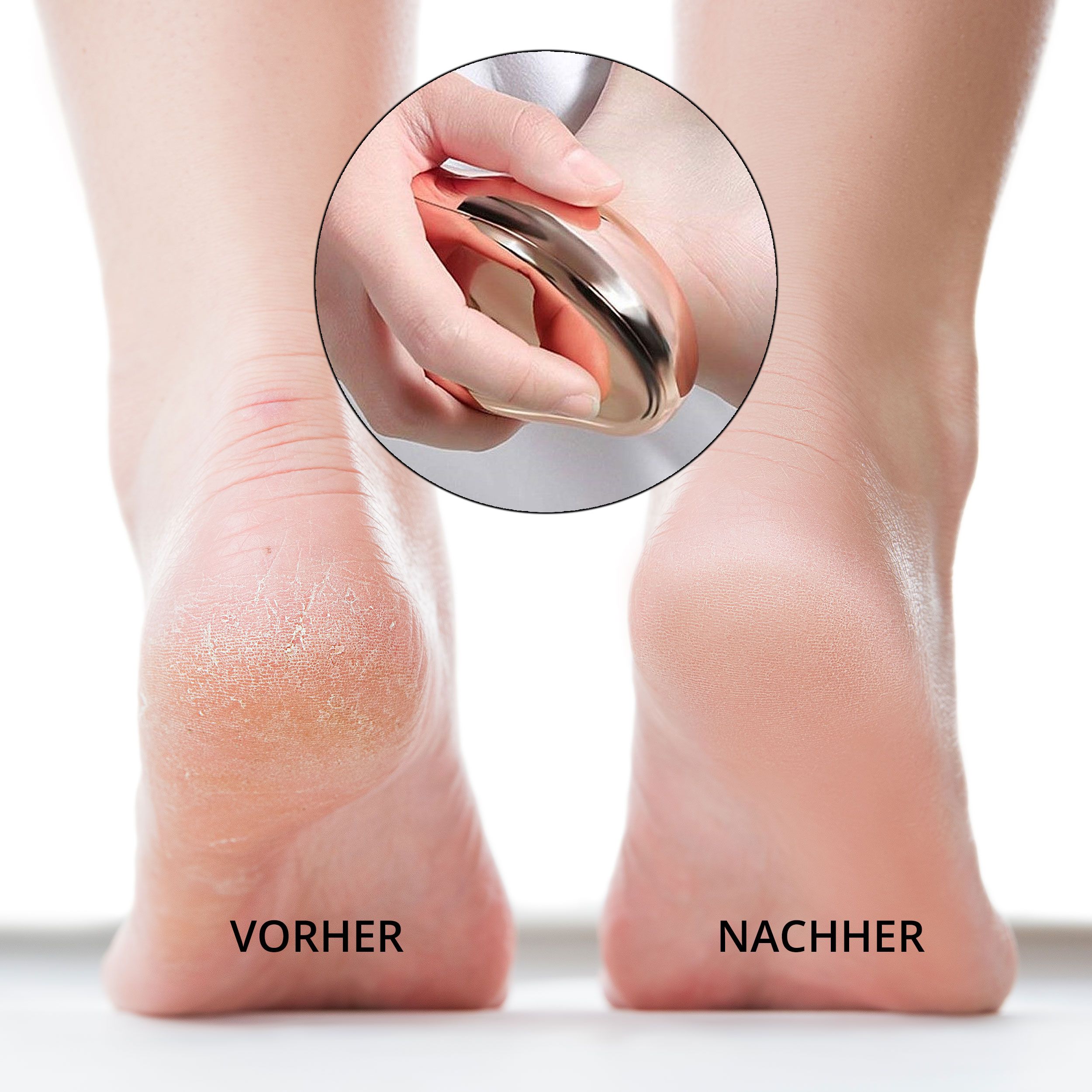 AILORIA DOUCETTE PRO SET foot callus remover set