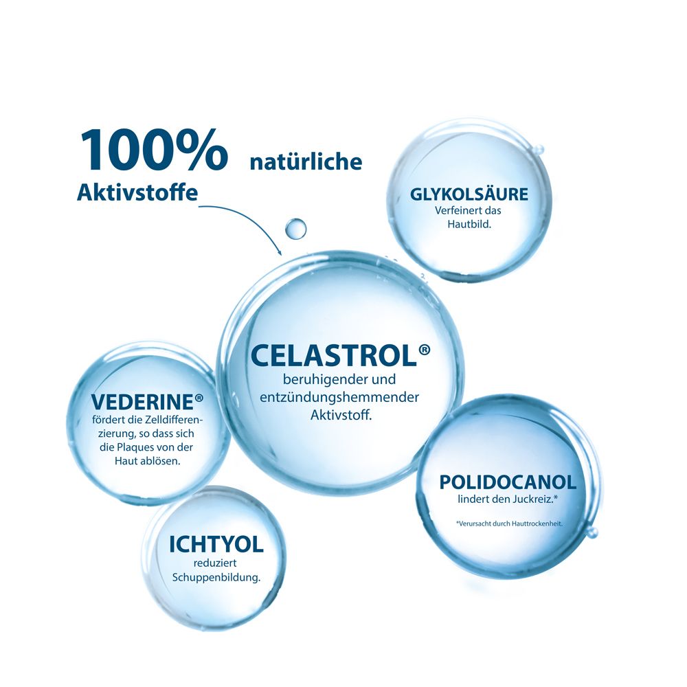 DUCRAY KERTYOL P.S.O. Concentrate - for skin prone to psoriasis