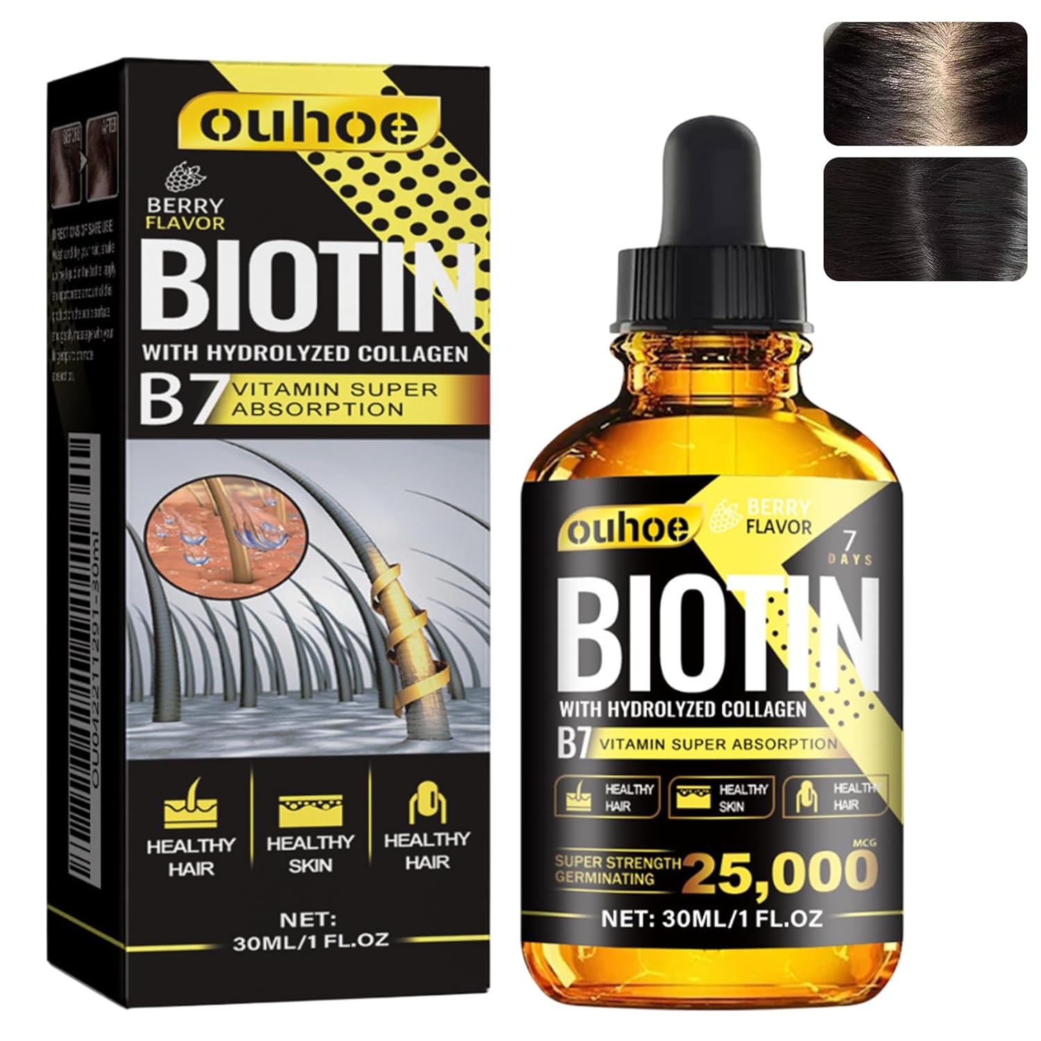 Hair Growth Serum, Hair Growth Serum for Women and Men, Hair Serum for Hair Growth, Scalp Oil, Hair Growth Acceleration, for Thinning Hair, Thickening and Reawakening (30 ml)
