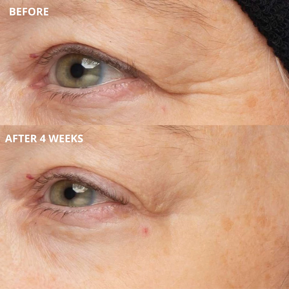 Perricone MD Cold Plasma Plus+ The Intensive Hydrating Complex intensive, hydrating cream