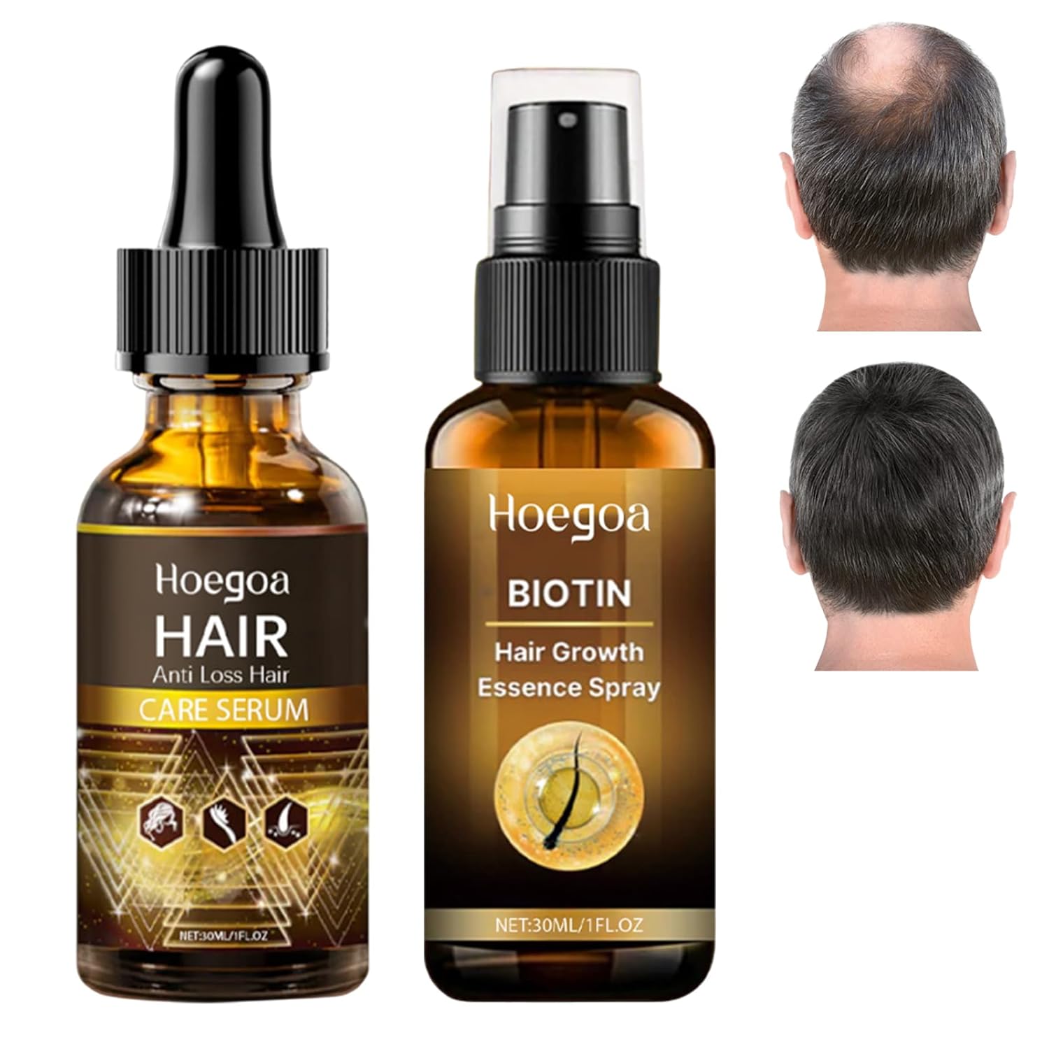2 Pieces Hair Growth Accelerating Hair Growth Serum Hair Serum for Hair Growth Hair Serum Hair Growth Serum Hair Growth Serum Hair Growth Serum Hair Growth Accelerate Hair Growth