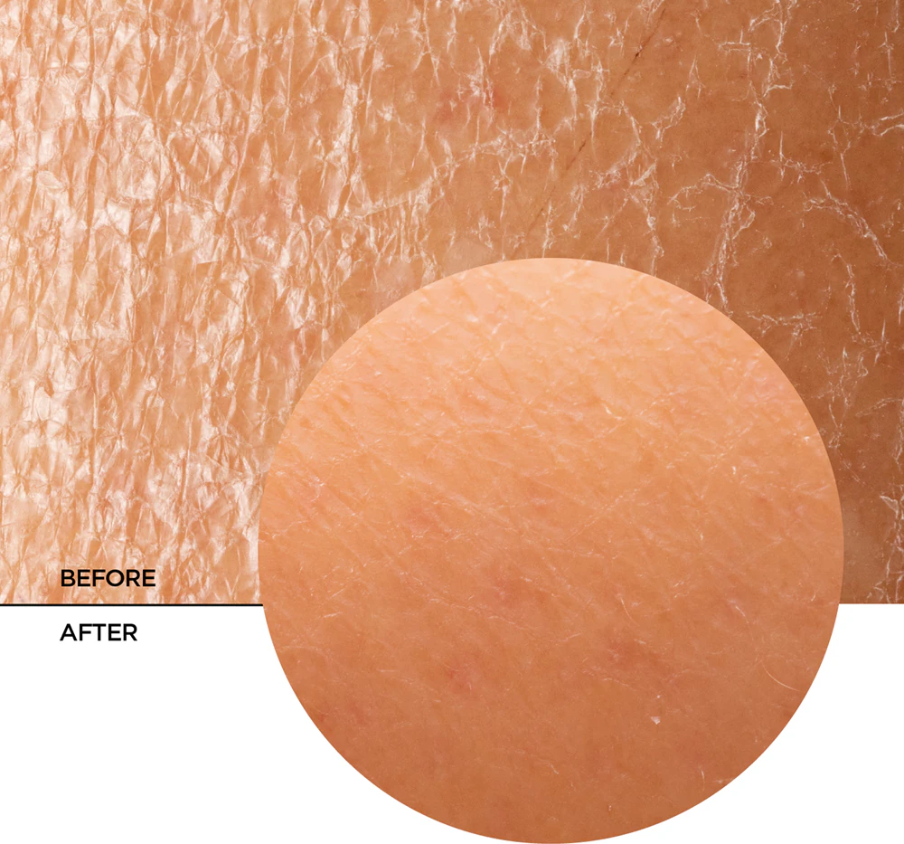 Revox B77 Skintreats Biotic Regenerating Filling Balm regenerating balm to nourish and moisturize
