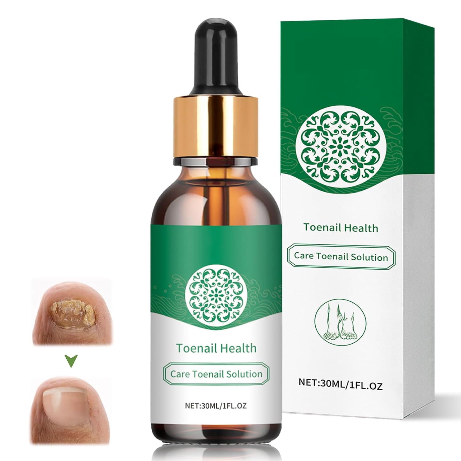 Nail Care Treatment, 30 ml Brittle Nails Nail Repair, Nail Care, Toenail Treatment for Hard Thick Toenails